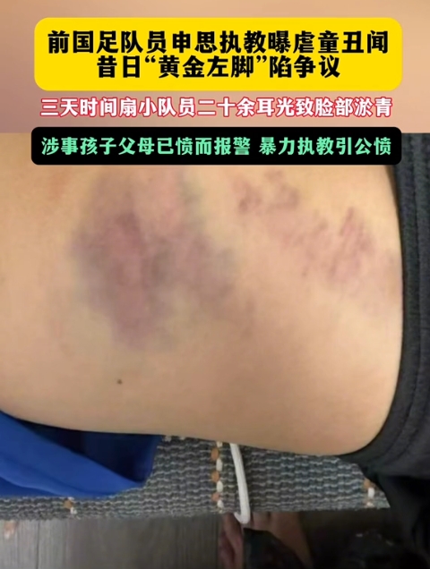 前国脚申思掌掴小球员视频曝光 家长已报警